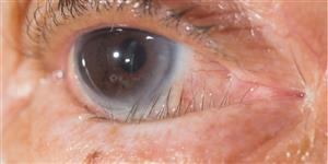 Gotas oculares de máxima resistencia, alivio del enrojecimiento para la  picazón en los ojos, alivio de ojos secos y ojos irritados, paquete de 1