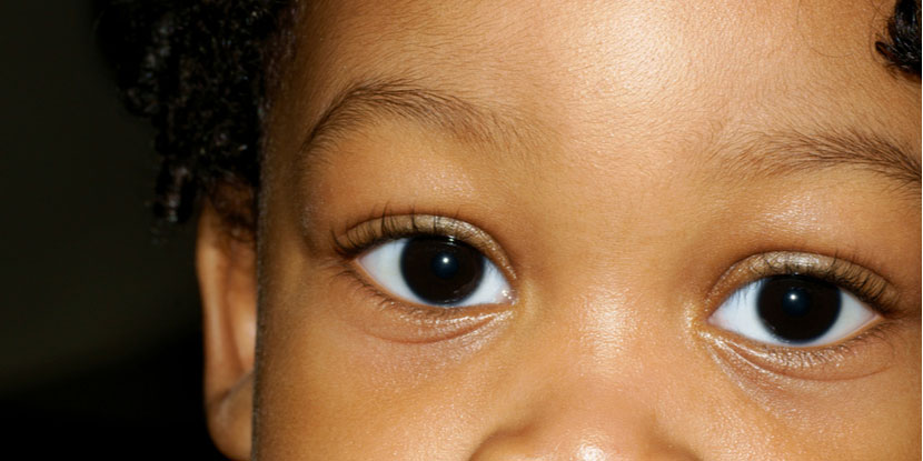 Child Blinking Eyes Often