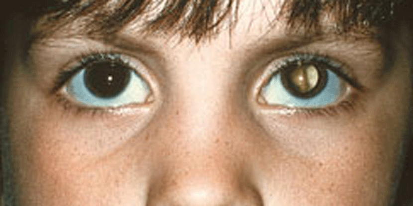 Mal del Ojo: 5 remedios caseros para curar este mal en niños y adultos