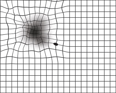 Have AMD? Save Your Sight with an Amsler Grid - American Academy of  Ophthalmology