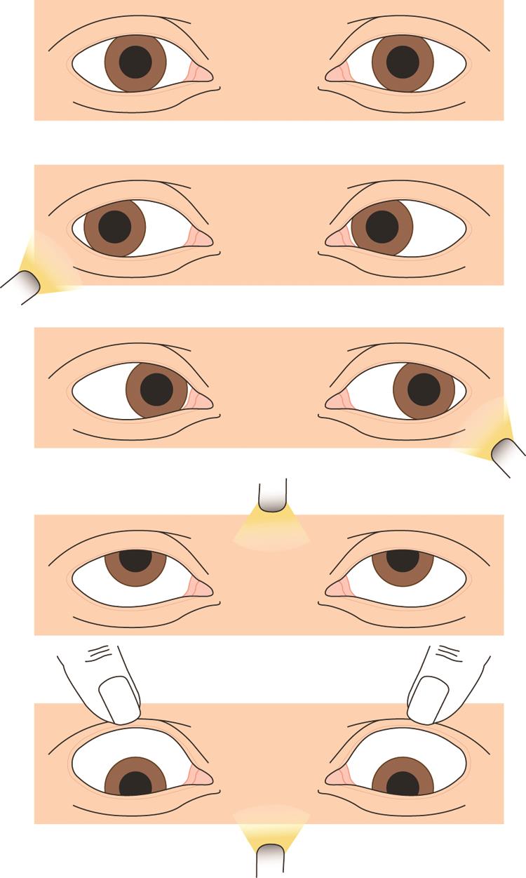 Assessing eye movements American Academy of Ophthalmology