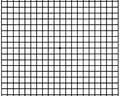 How to use the amsler grid - Towne Lake Eye Associates