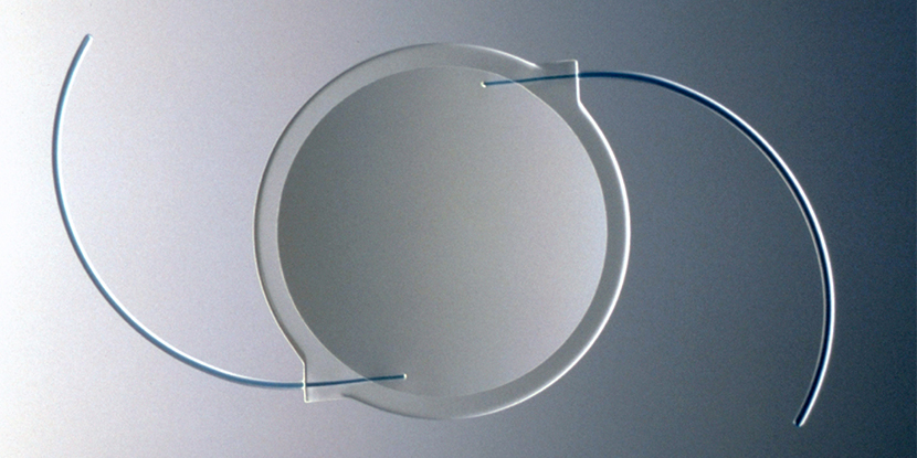 Reemplazo de lente y la cirugía de las cataratas - American Academy of  Ophthalmology