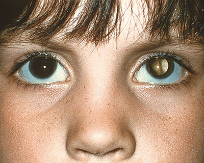 images of kids eyes